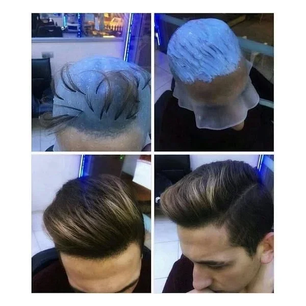 Profesyonel Silikon Delikli Röfle Bonesi - Görsel 7