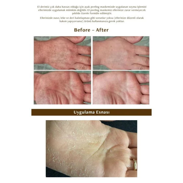 Mjcare Hand Peeling Soyulan El Maskesi - Görsel 6