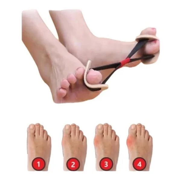 Bunyon Ayak Baş Parmak Kemik Düzeltici Bunyon Hallux Vagus Egzersiz Lastik Egzersiz Lastiği - Görsel 3