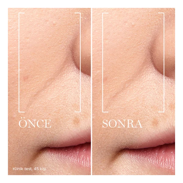Lancome Renergie H.C.F Triple Yaşlanma Karşıtı 50 Ml Yüz Serumu - Görsel 5