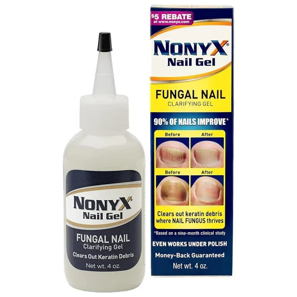 Nonyx Nail Gel 113gr - Görsel 2