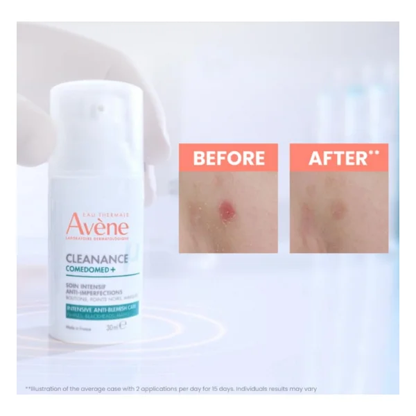 Avene Cleanance Comedomed+ Niasinamid içeren Cilt Kusurları için Yoğun Bakım Kremi 30 ml - Görsel 6