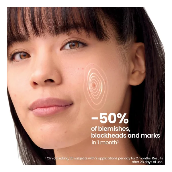Avene Cleanance Comedomed+ Niasinamid içeren Cilt Kusurları için Yoğun Bakım Kremi 30 ml - Görsel 3
