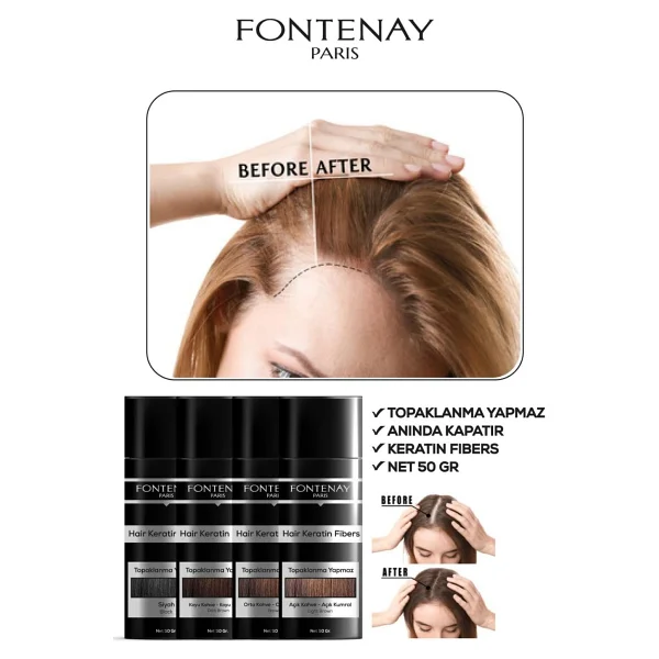 Fontenay Saç Dolgunlaştırıcı Keratin Fibers Koyu Kahve Topik Saç Tozu 50Gr + Saç Spreyi 400Ml 2Li Set 2 - Görsel 2