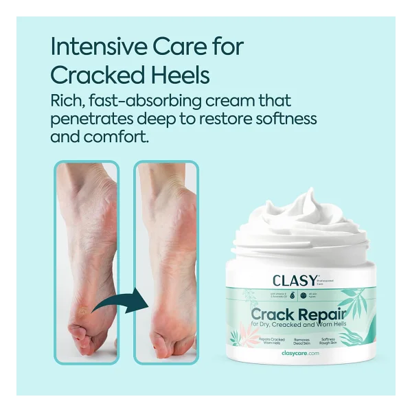 Clasy Care Ayak Ve Topuk Çatlak Onarıcı Krem 100 Ml - Görsel 2