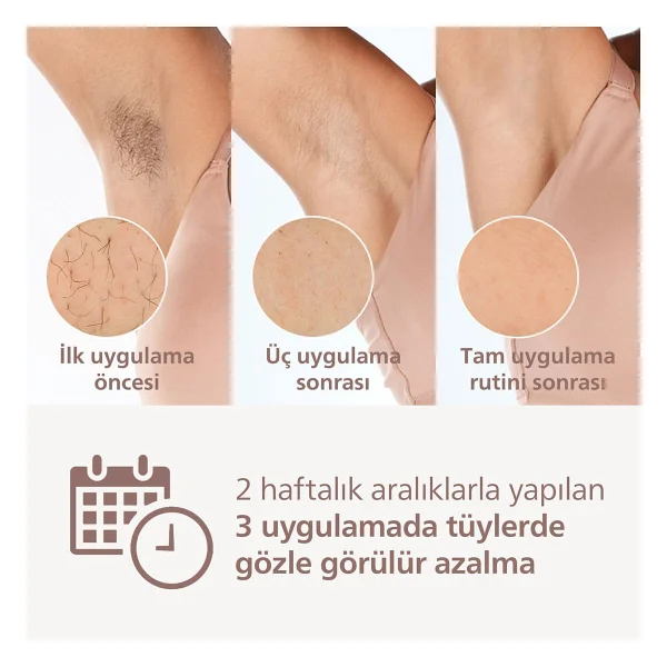 Philips Lumea Brı951/03 Ipl Lazer Epilasyon Aleti - Görsel 4