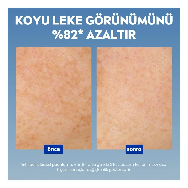 Nivea Luminous630 Thiamidol Leke Karşıtı 30 Ml Yüz Serumu - Görsel 10