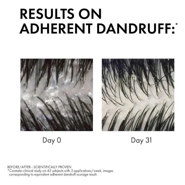 Vichy Dercos Anti-Dandruff Kuru Saçlar İçin 200 Ml Kepek Şampuanı - Görsel 2