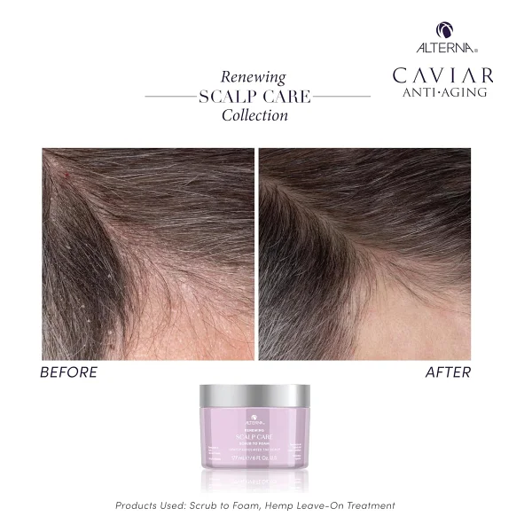 Alterna Caviar Renewing Scalp Care Scrub To Foam - Görsel 5