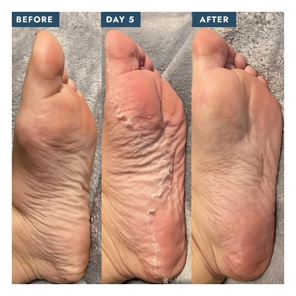 Voesh Peeling Etkili Çorap Ayak Maskesi - Görsel 5
