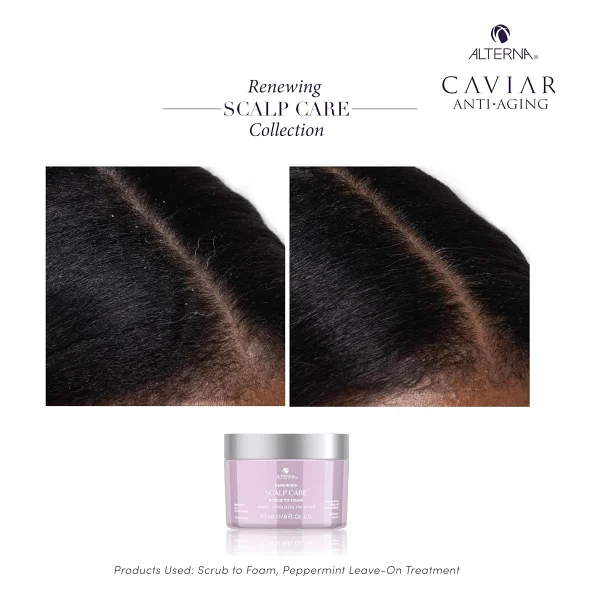 Alterna Caviar Renewing Scalp Care Scrub To Foam - Görsel 6
