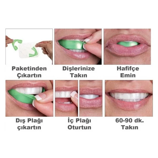 Opalescence Ultradent Go Nane 8'li Diş Beyazlatma Hazır Kalıp - Görsel 4