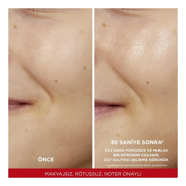 L'oreal Paris Revitalift %5 Saf Glikolik Asit Peeling Etkili Tonik 180 Ml - Görsel 5