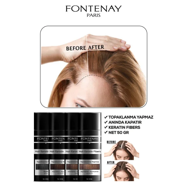 Fontenay Keratin Fibers Açık Kahve Topik Saç Tozu 50gr + Saç Spreyi 400ml 2'li Set 2 - Görsel 3