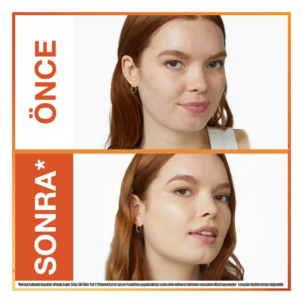 Maybelline New York Super Stay Skin Tint C Vitaminli 05 30 Ml Serum Fondöten - Görsel 4