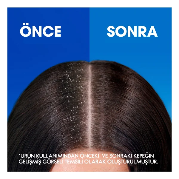 Head & Shoulders Klasik Bakım 750 ml Kepek Şampuanı - Görsel 5