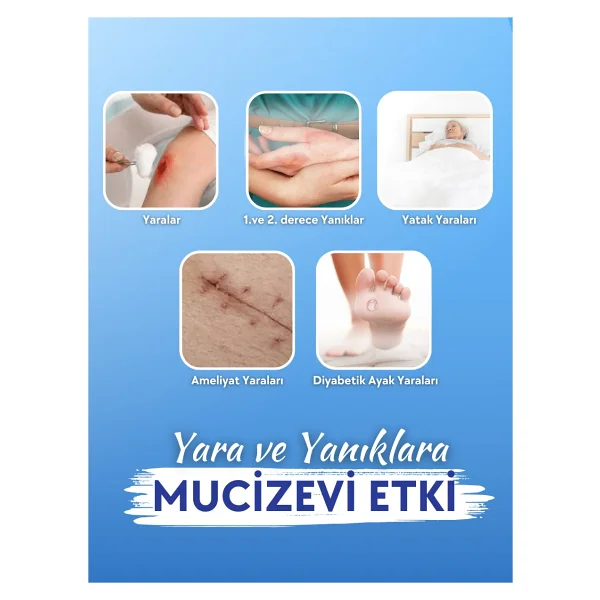 Actolind Gel Plus 50 Ml Yara Iyileştirme Jeli - Görsel 3