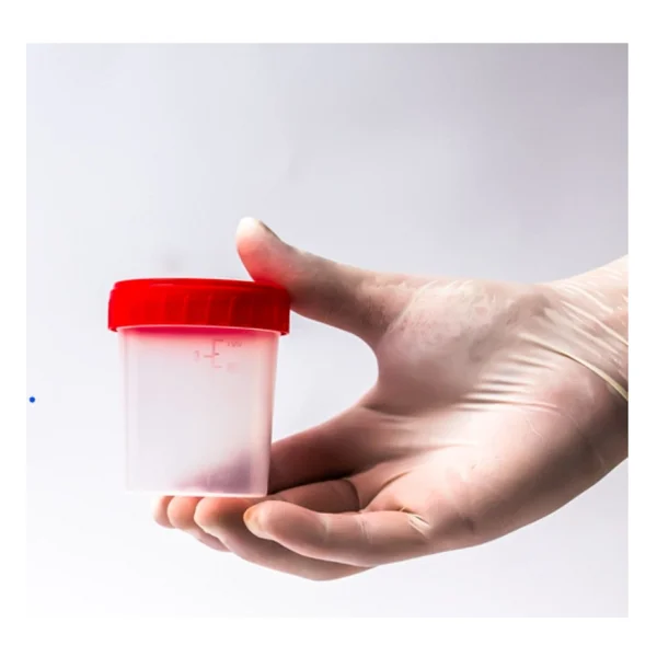 Aklab Group Düz Idrar Kabı 100 Ml Non Steril 50 Adet - Görsel 2