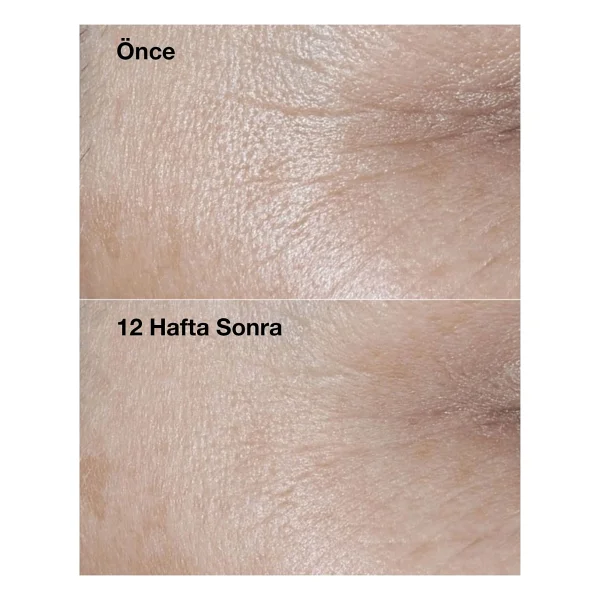 Clinique Smart Clinical Repair Spf 30 50 Ml Yaşlanma Karşıtı Krem - Görsel 7