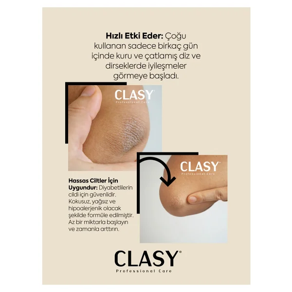 Clasy Care Diz Ve Dirsek Bakım Kremi - Çatlak, Kurumuş, Koyulaşmış Sert Deriye Karşı (Clasy Crack Repair Cream) - Görsel 4