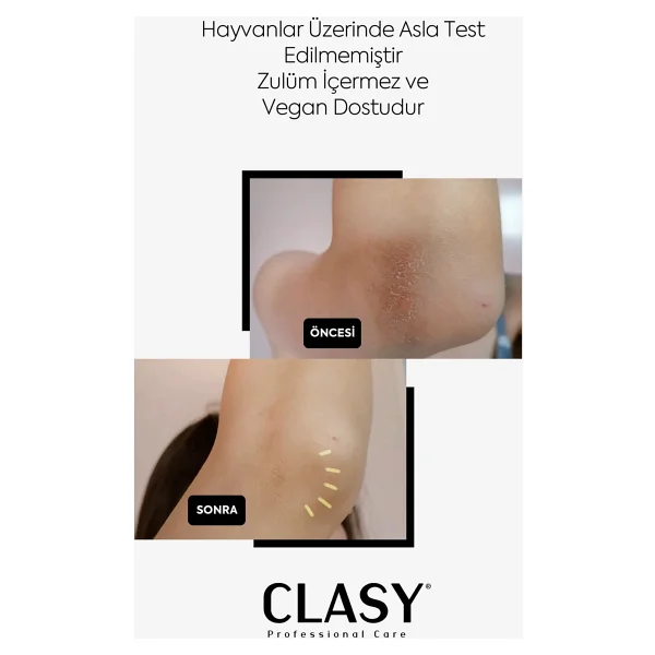 Clasy Care Diz Ve Dirsek Bakım Kremi - Çatlak, Kurumuş, Koyulaşmış Sert Deriye Karşı (Clasy Crack Repair Cream) - Görsel 5