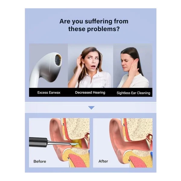 Bebird T5 3mp Kamera Siyah Şarjlı Kulak Temizleme Aleti - Görsel 5