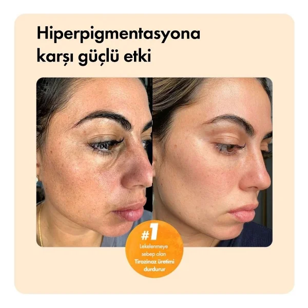 Ph Lab Kojiso Leke Karşıtı 50 Gr Kojic Asit Sabunu - Görsel 5
