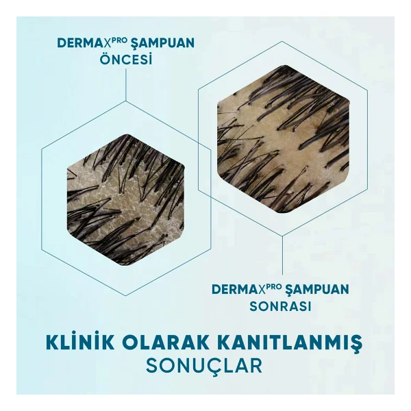 Head & Shoulders Derma X Pro Onarıcı Nemlendirici 300 Ml Şampuan - Görsel 5