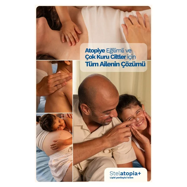Mustela Stelatopia Lipit Krem 150 Ml 2 Adet - Görsel 2