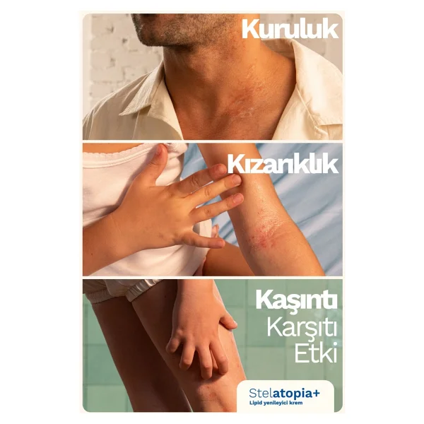 Mustela Stelatopia Lipit Krem 150 Ml 2 Adet - Görsel 4