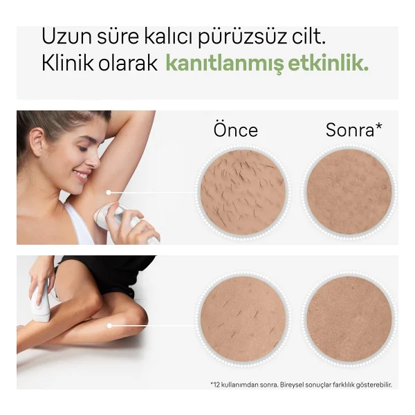 Braun Silk Expert Pro 3 Pl3132 Ipl Lazer Epilasyon Aleti - Görsel 4