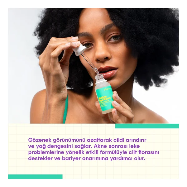 She Vec Hi Girls Bye Pores %10 Niacinamide + %1 Zinc Pca Yüz Serumu 30 Ml - Görsel 3