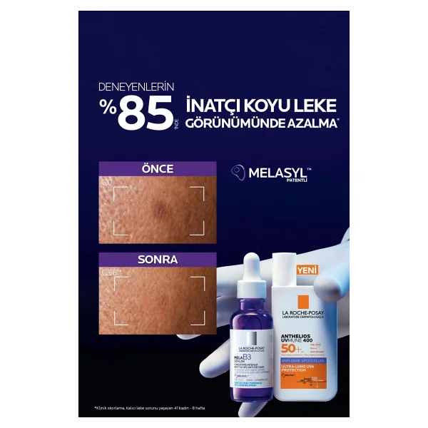 La Roche-Posay Anthelios Uvmune Anti Dark Spots Fluid 50 Ml 2 Adet 50 Faktör Güneş Kremi - Görsel 2