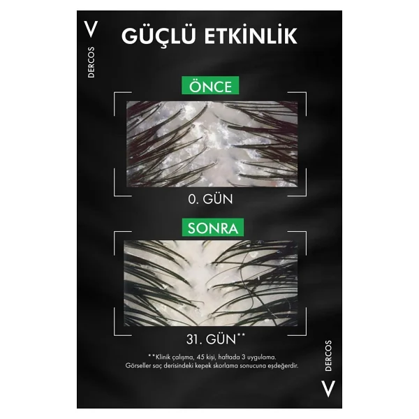 Vichy Dercos Anti-Dandruff Normal Ve Yağlı Saçlar İçin 390 Ml 2 Adet Kepek Şampuanı - Görsel 6