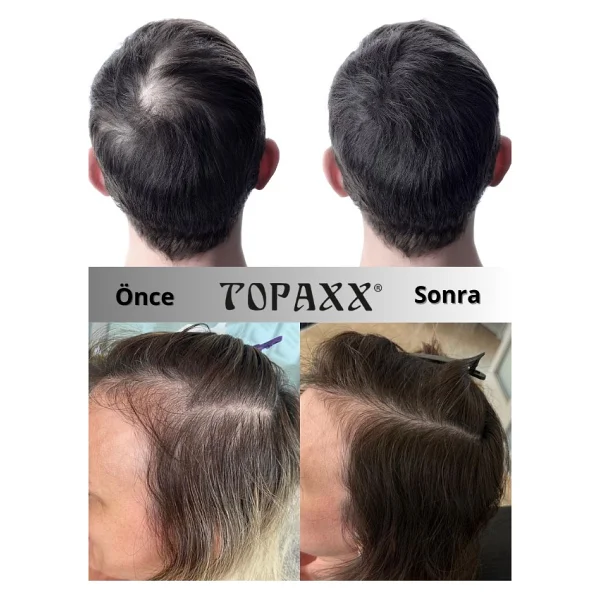 Topaxx Koyu Kahve Suda Çıkmayan Topik Pudra 14 G - Görsel 5