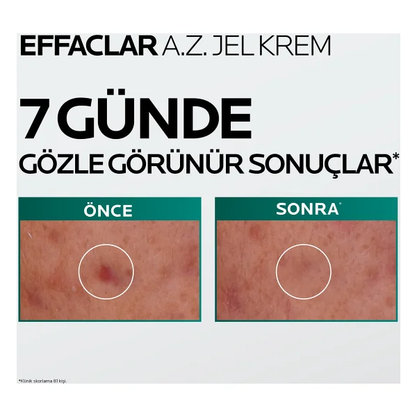 La Roche-Posay Effaclar A.Z. Sivilce Ve Kırışıklık Karşıtı 40 Ml Jel Nemlendirici Krem - Görsel 8