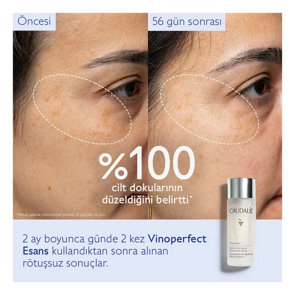 Caudalie Vinoperfect Concentrated Brightening Essence 100 ml Leke Karşıtı Aydınlatıcı Esans - Görsel 6