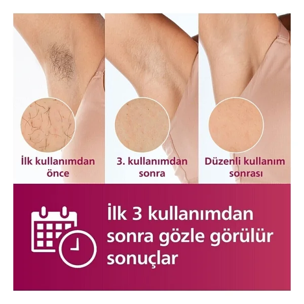 Ipl Lazer Epilasyon Cihazı, 2 Akıllı Başlık (Vücut Ve Yüz Başlığı), + Tüy Alma Cihazı +Tıraş Makinesi + Lambader (Onerous) - Beyaz - Görsel 5