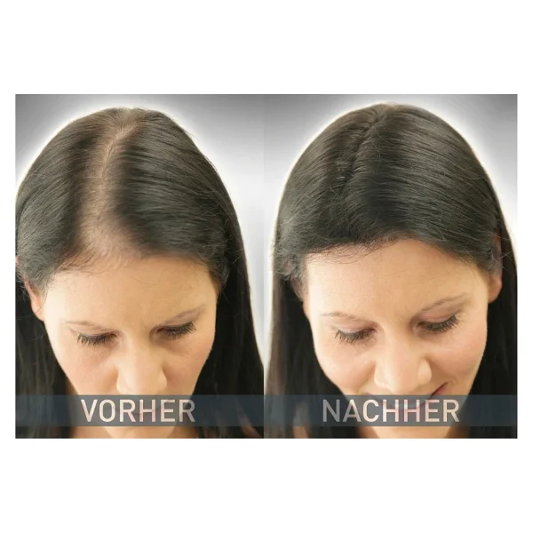 Cover Hair 14 Gramm Saç Fiberi Dolgunlaştırıcı Kellik Kapatıcı Toz (Topik Tozu) (Koyu Kahverengi) - Görsel 5