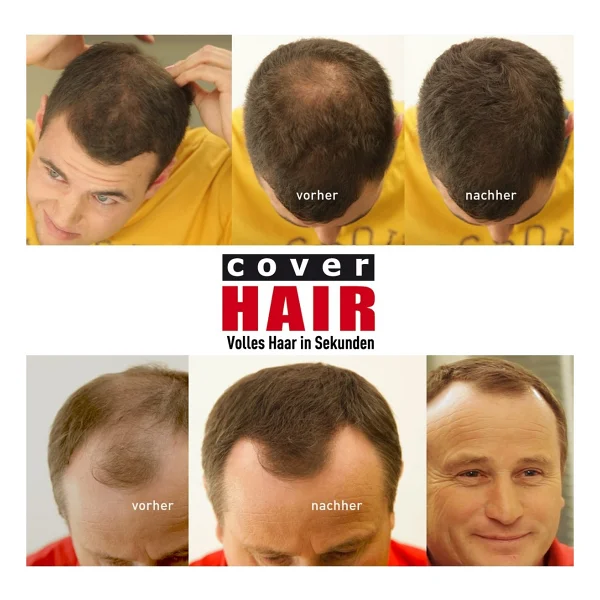 Cover Hair 14 Gramm Saç Fiberi Dolgunlaştırıcı Kellik Kapatıcı Toz (Topik Tozu) (Koyu Kahverengi) - Görsel 7