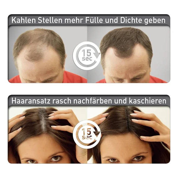 Cover Hair 14 Gram Saç Fiberi Dolgunlaştırıcı Kellik Kapatıcı Siyah Toz (Topik Tozu) - Görsel 4