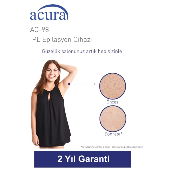 Acura Ac-98 Ipl Lazer Epilasyon Aleti - Görsel 2