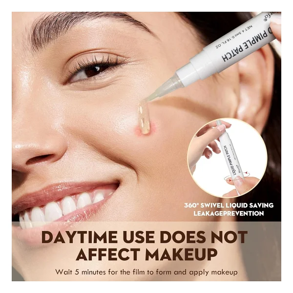 Jejudo Pimple Patch,Akne Bandı(9mm&12mm)+4,5 Ml Likit Pimple Pen,%100 Hidrokolloid,%2 Salisilik Asit - Görsel 2