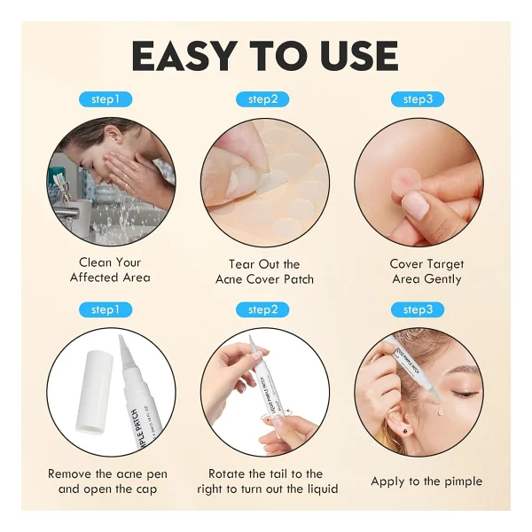 Jejudo Pimple Patch,Akne Bandı(9mm&12mm)+4,5 Ml Likit Pimple Pen,%100 Hidrokolloid,%2 Salisilik Asit - Görsel 3