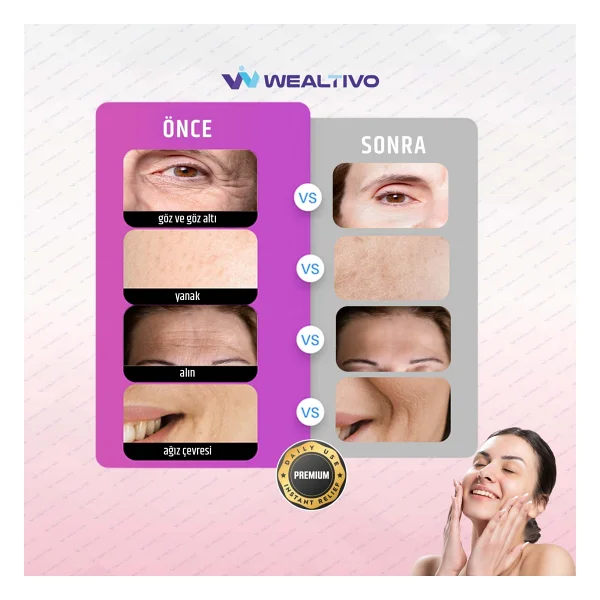 Wealtivo Yüz Bandı (144 Adet) Şeffaf Kırışıklık Karşıtı Yüz Germe Ve Anında Kaldırma Bantları - Premium Wrinkle Patch Seti - Görsel 4