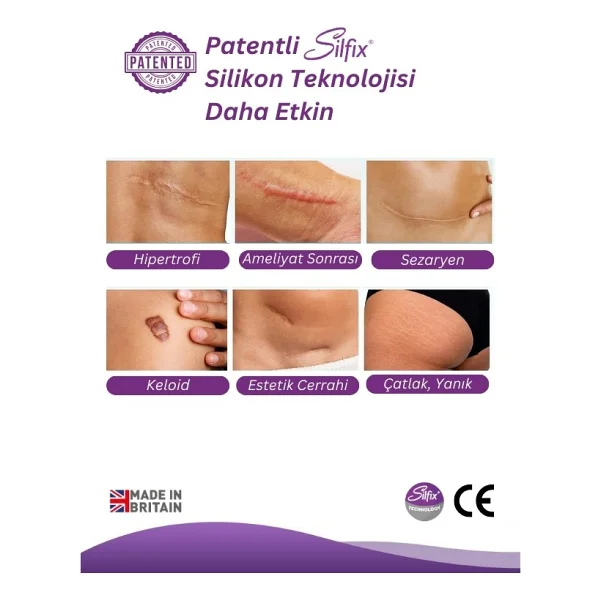 Advancis Medical Uk Siltape Soft Silikon Yara İzi Dikiş İzi Sezaryen Yanık Estetik Bant 2 Cm X 3 M - Görsel 3