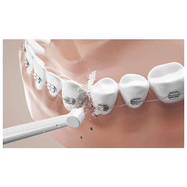 Cosmo Technology Q1 Ultrasonic Ağız Ve Diş Bakım Seti - Görsel 9