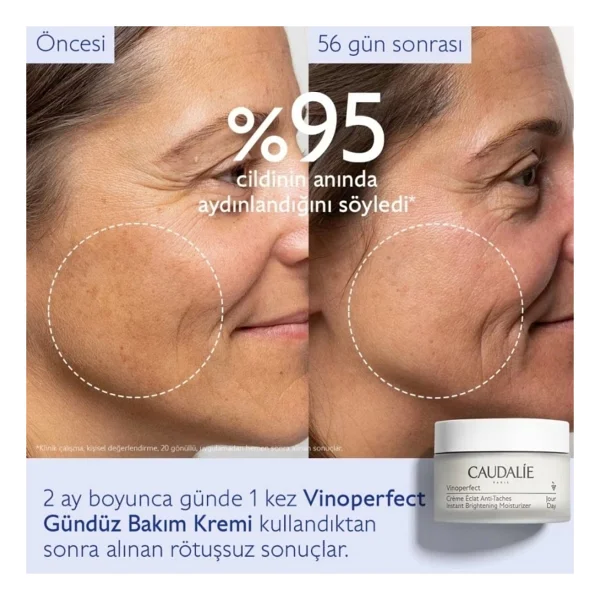 Caudalie Güneş, Akne Ve Yaşlanma Etkilerini Karşı Yardımcı Işıltı Veren Gündüz Bakım Kremi 50 Ml - Görsel 4