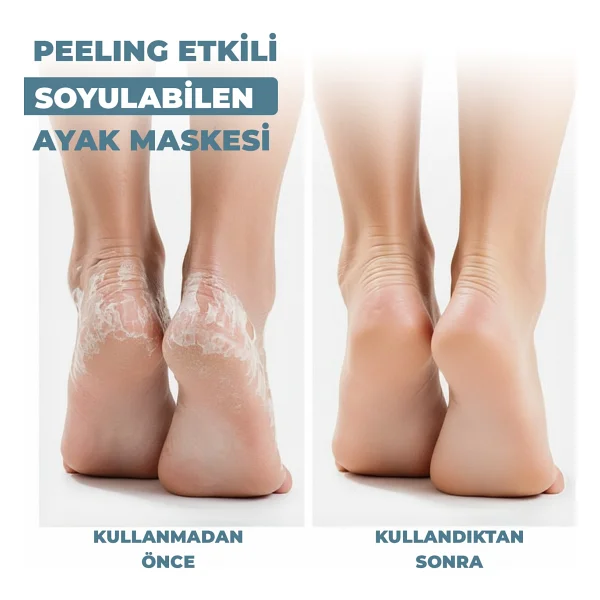 Dermokil Peeling Etkili Soyulabilir Ayak Maskesi 30 Ml - Görsel 2