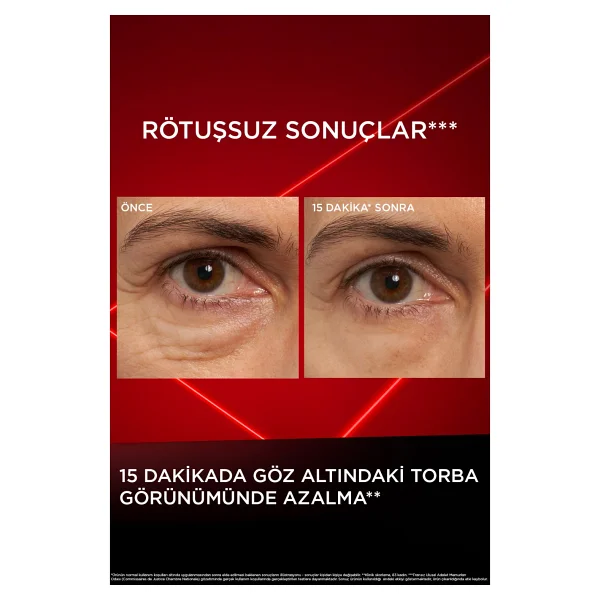 L'oreal Paris L'oreal Paris Revitalift Lazer Eyebag Göz Altı Torbalarına Karşı Göz Kremi + Instant Anti Age Eraser 01 Light - Görsel 4